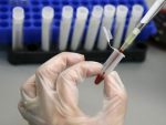 СРБИЈА: Жена заражена ХИВ-ом након трансфузије крви